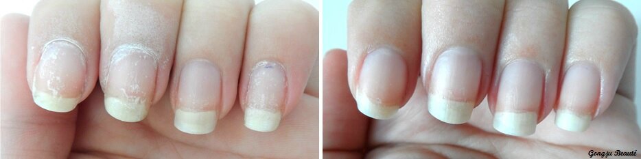 Comme vous pouvez le voir sur l\u0027image de gauche, les ongles sont bien abimés à cause du vernis, j\u0027ai donc fait un soin avec de l\u0027huile d\u0027amande douce (voir