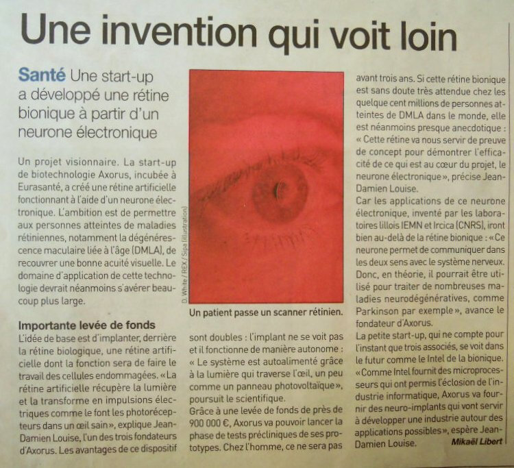 yeux axorus retine