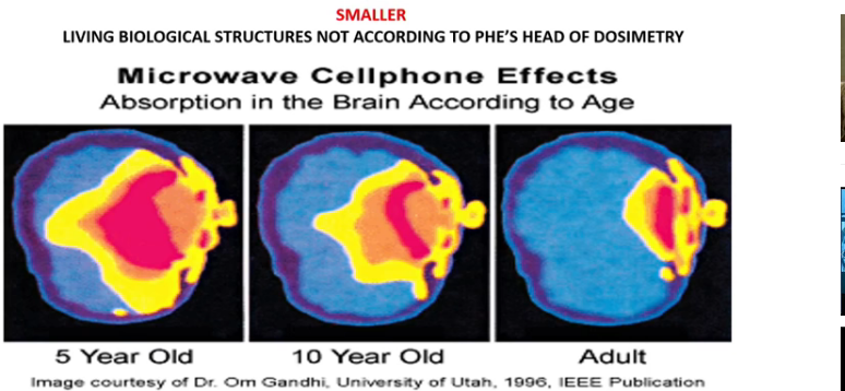 head-radiation